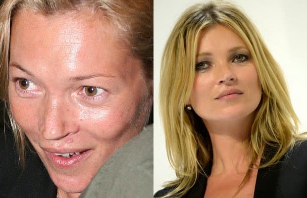 Kate Moss