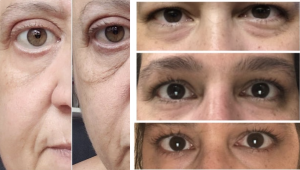28-04-firmingeyecream