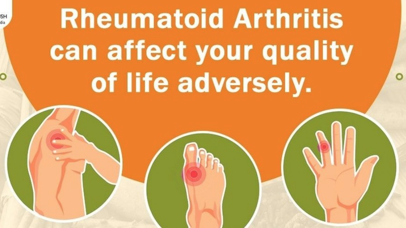 arthritis-2