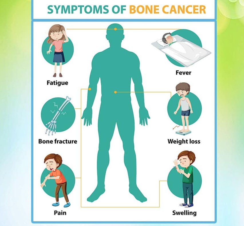 bone-cancer