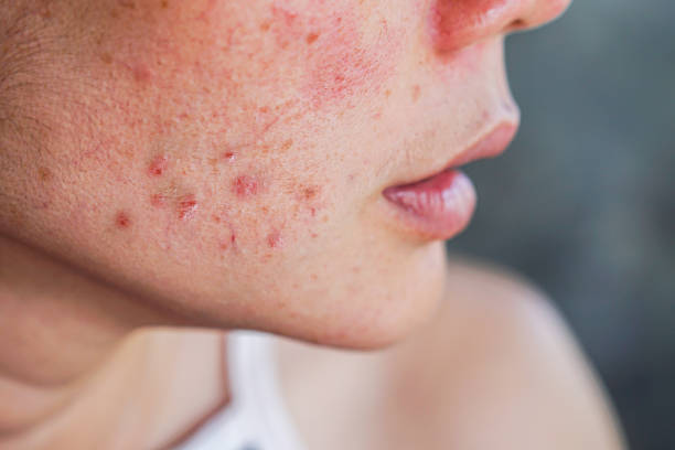 istockphoto-1270415883-612x612-1