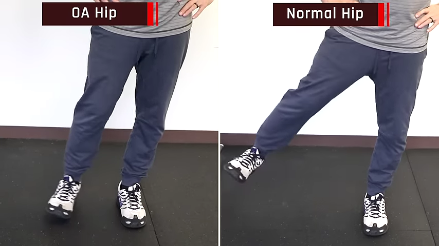 1214-hip-osteoarthritis-best-exercises-stretches-advice-for-hip-groin-pain-relief-00-01-03