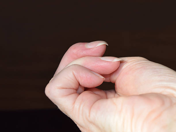 this-is-a-photo-of-womans-finger-with-a-bent-hooked-fingernail