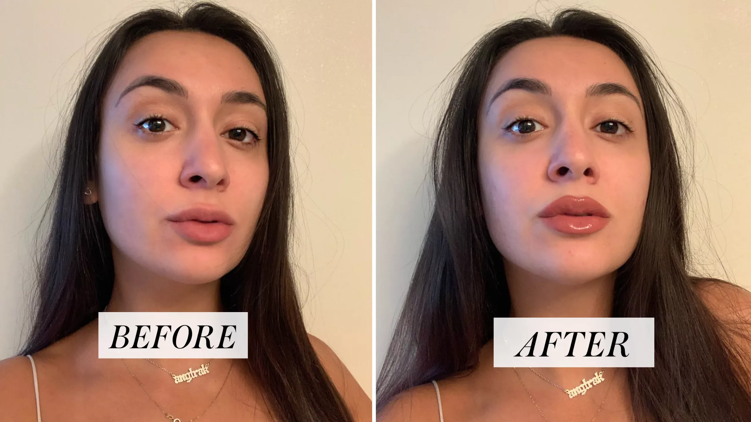 angela-before-and-after-overlining-lips-lede