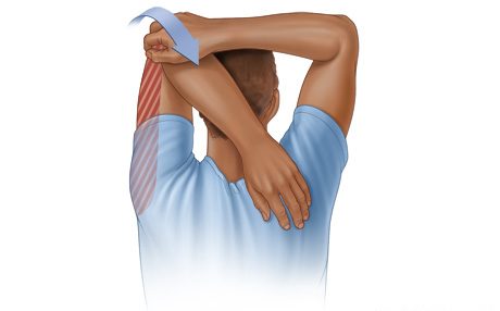 tricep-stretches