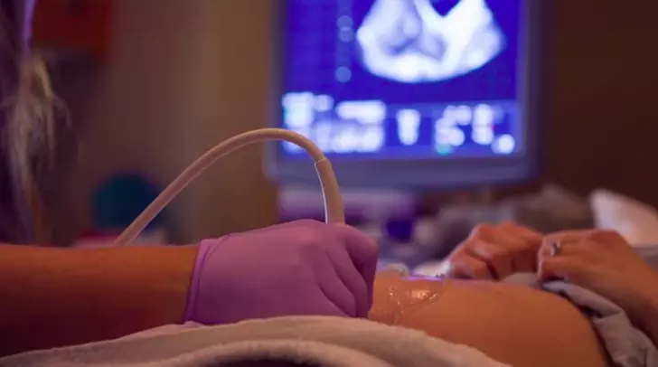 womans-belly-keeps-growing-doctor-sees-scan-and-calls-cops_10