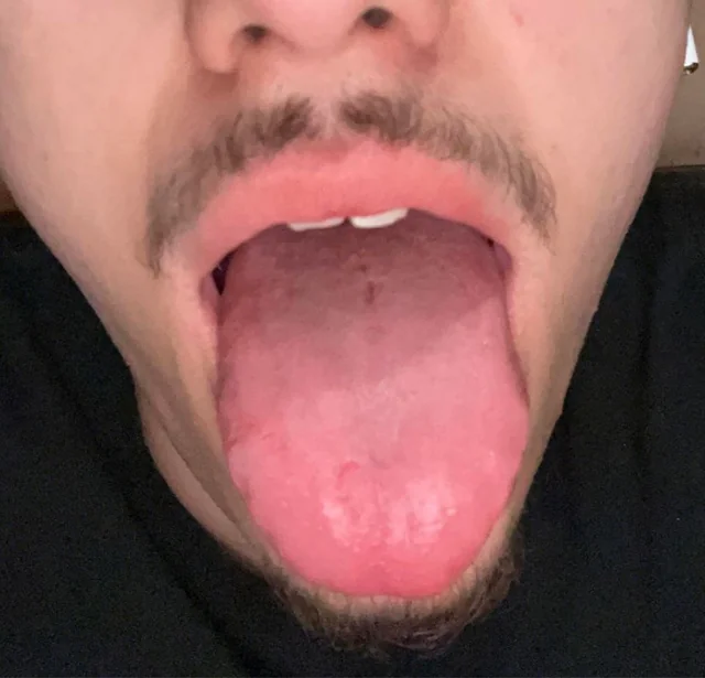 38-reddit