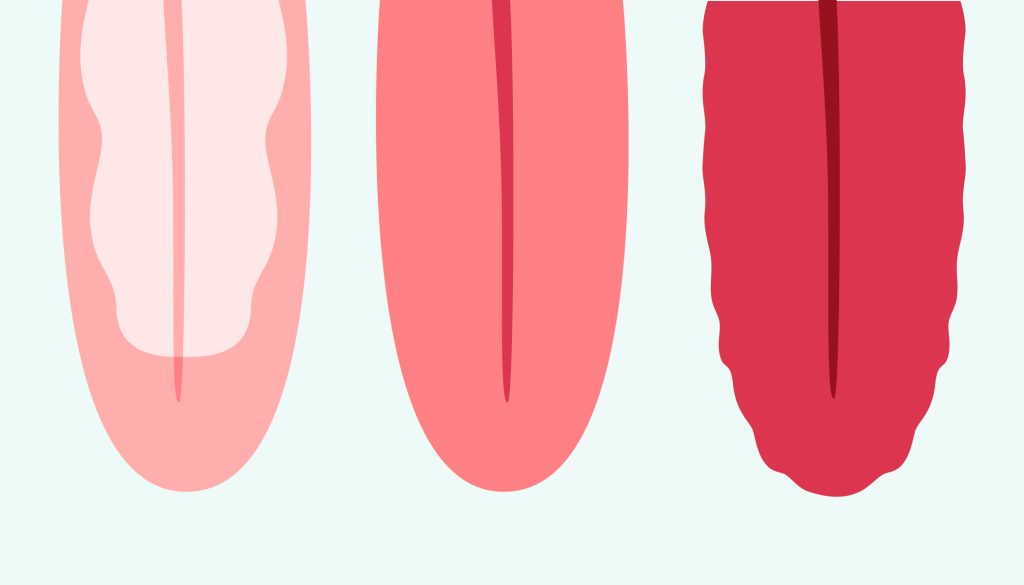 5-4-1024x585