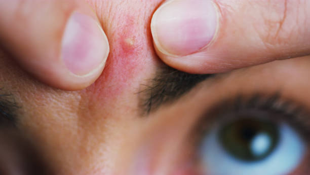 istockphoto-1178951443-612x612