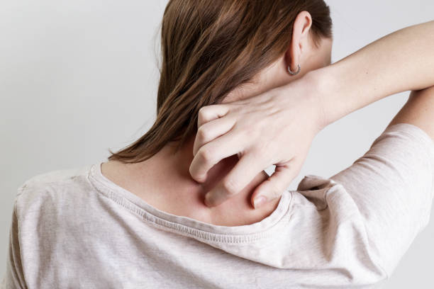 close-up-view-of-woman-scratching-her-neck