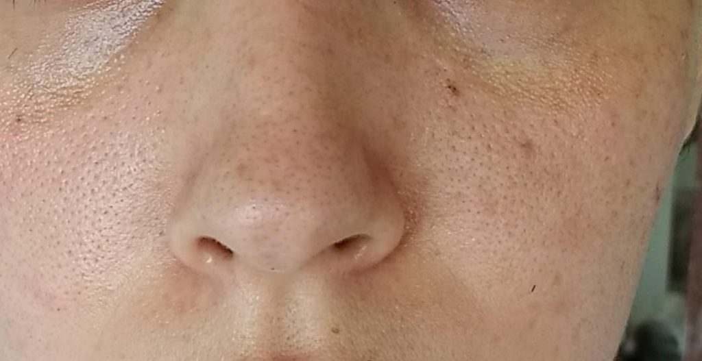 pores-1024x1022