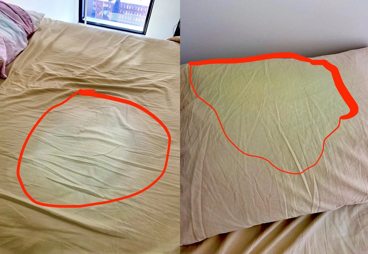 what-could-be-causing-these-sheet-stains-v0-agu5i7h3tek81