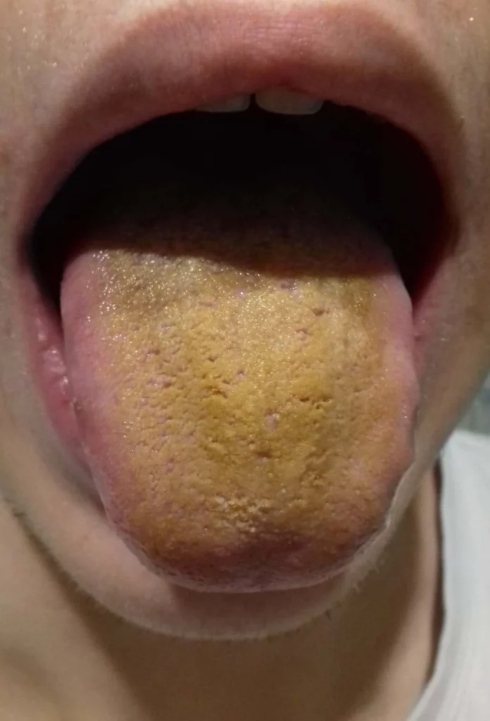 yellow-reddit-696x1024