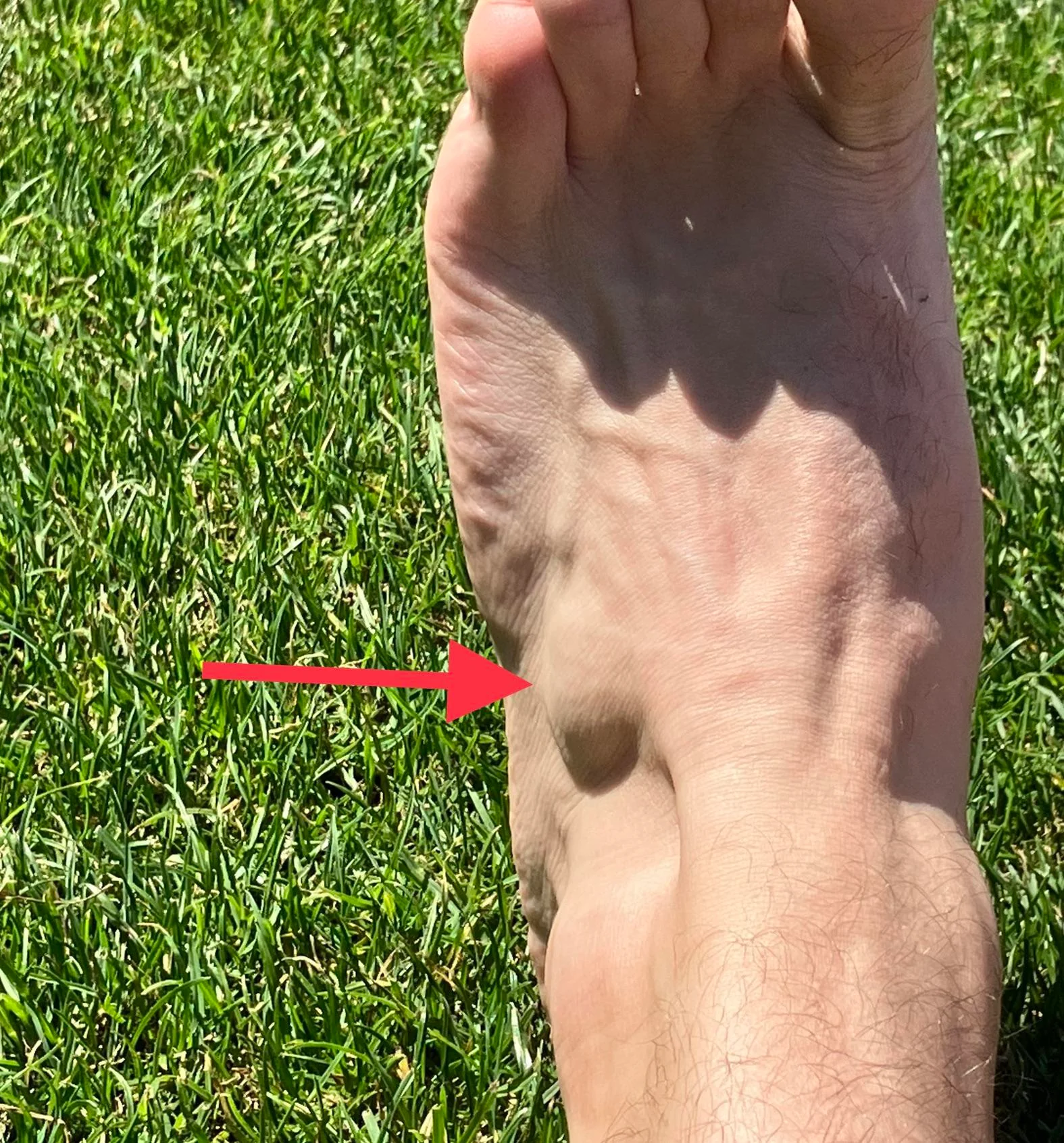 foot-muscles