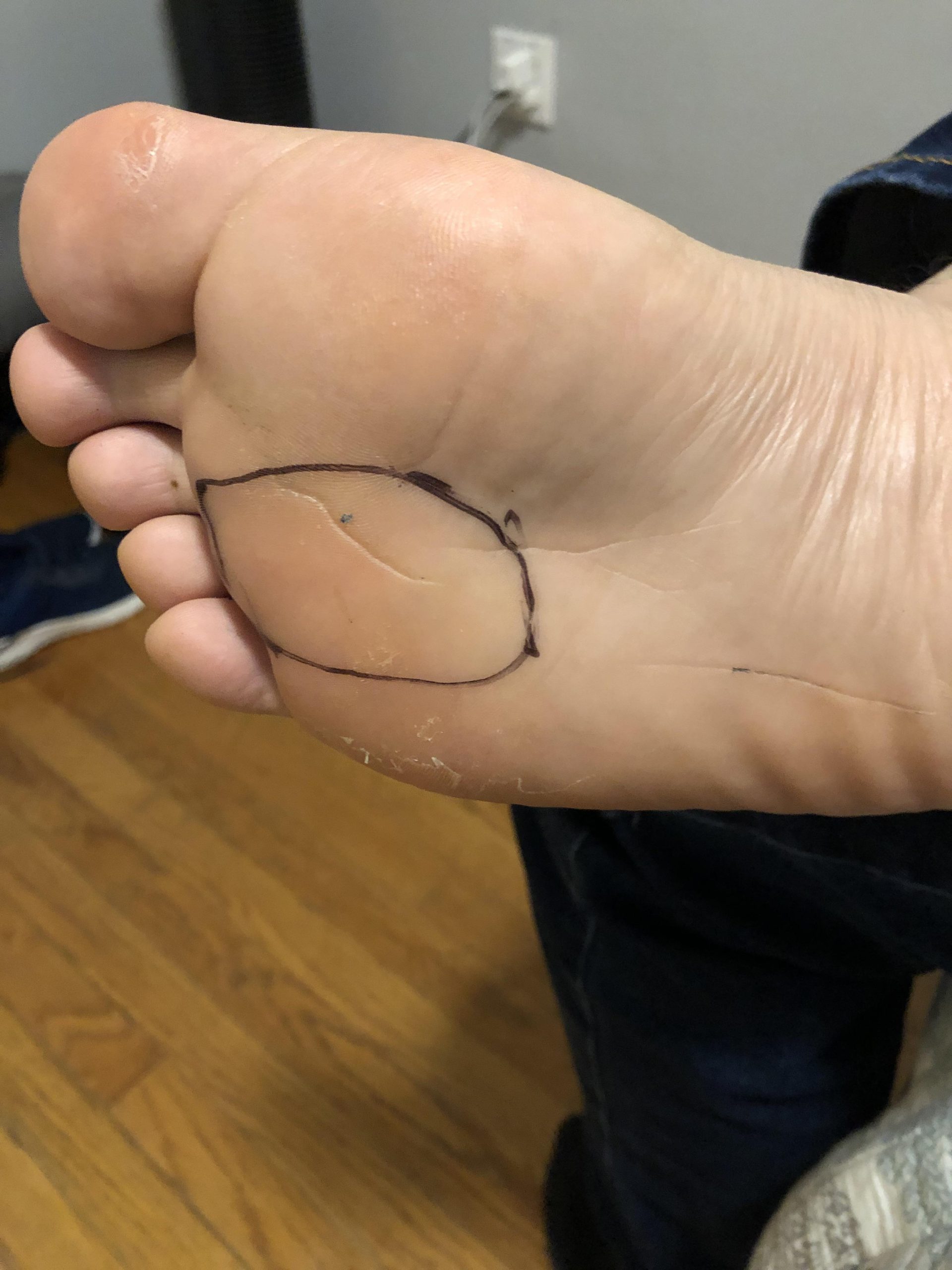 foot-pain-scaled