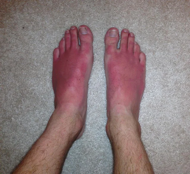 foot-sunscreen