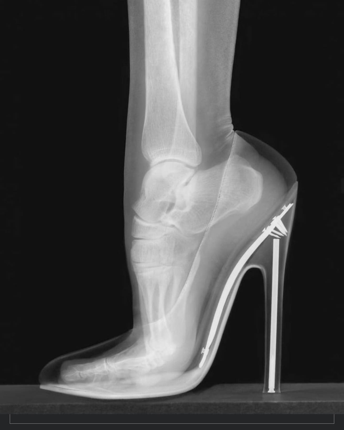 high-heel-arch