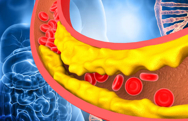 blocked-vein-or-clogged-arteries-3d-illustration