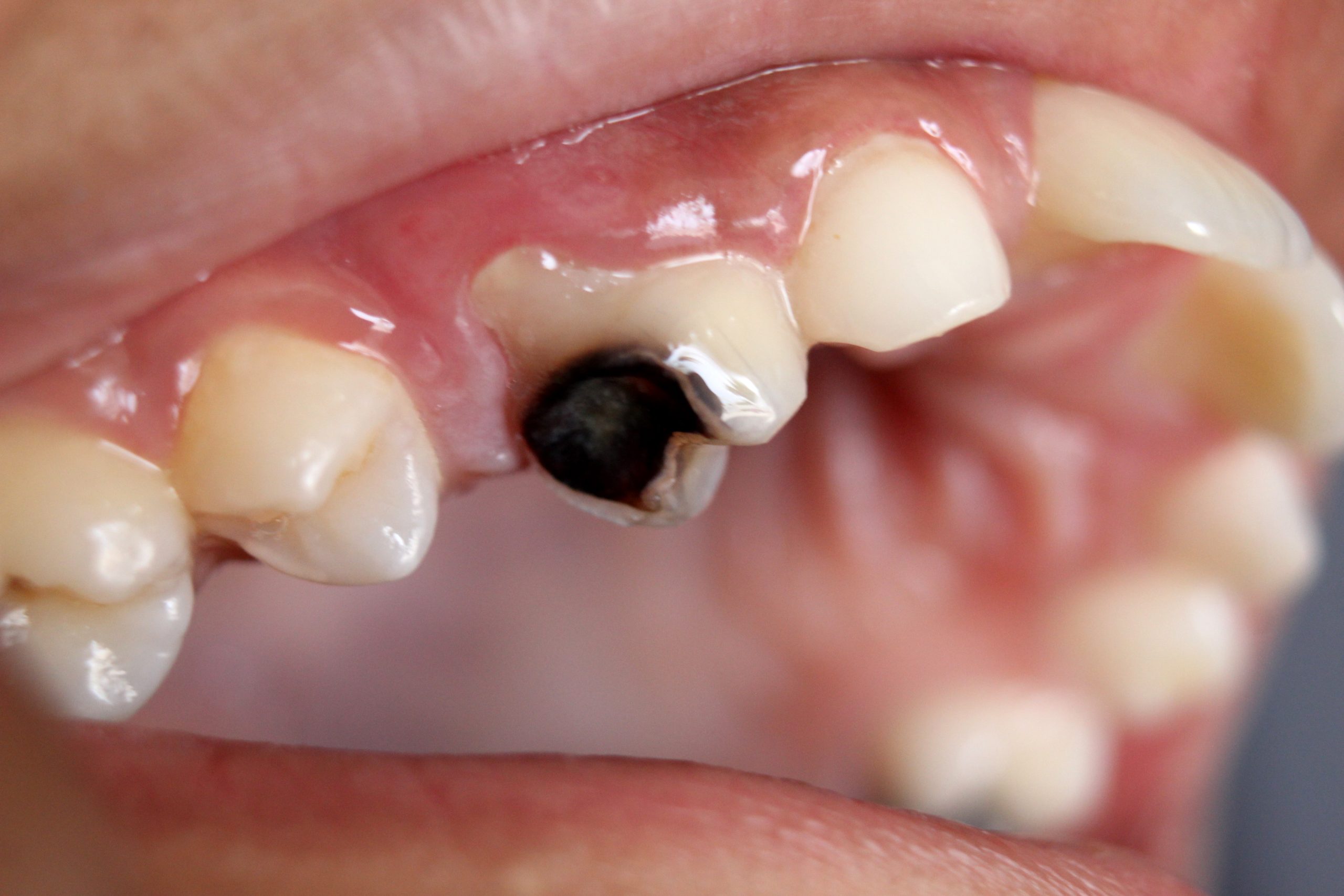 teeth-3