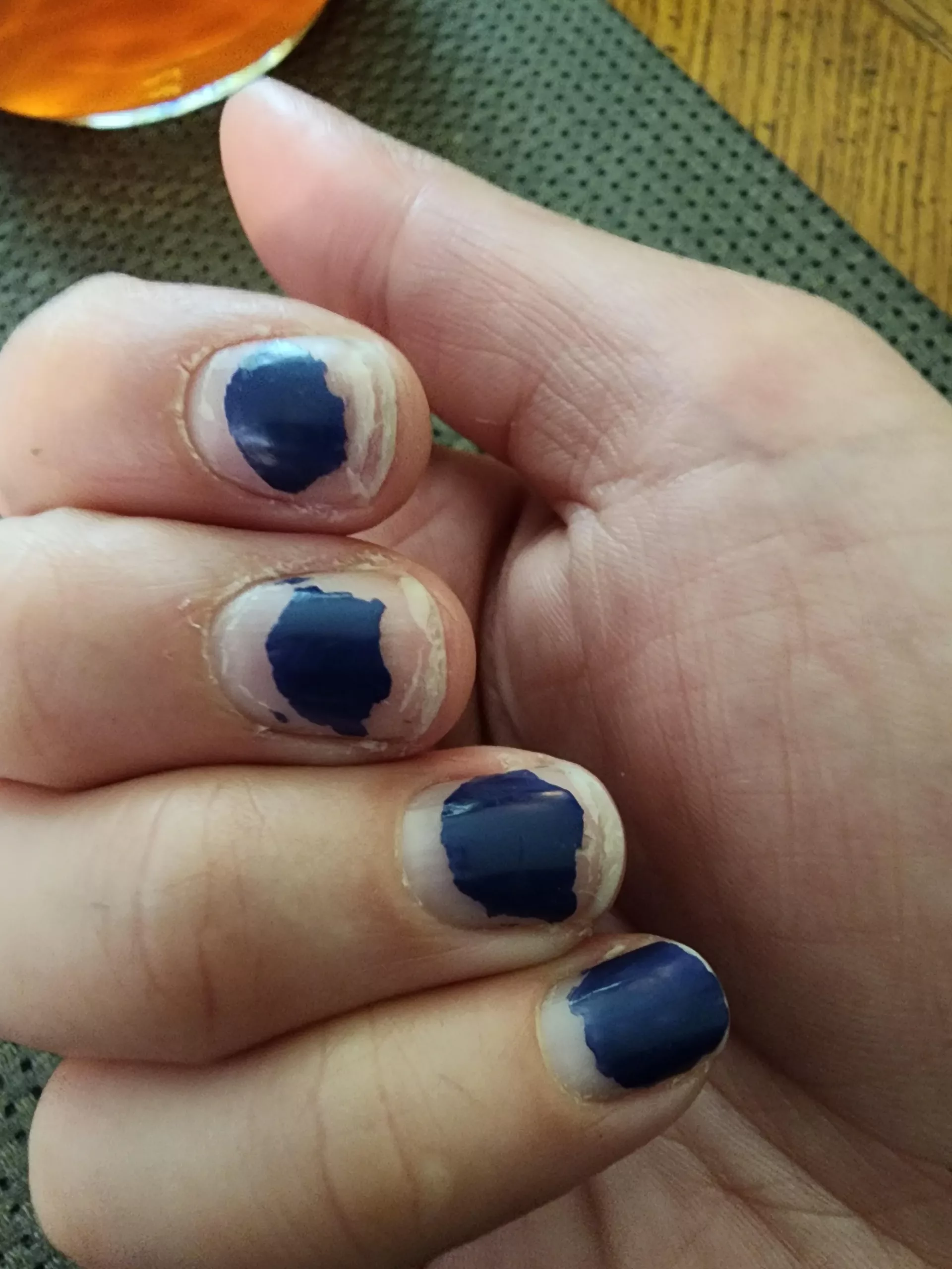 why-do-the-ends-of-my-nails-split-and-peel-v0-sto6spteap0b1