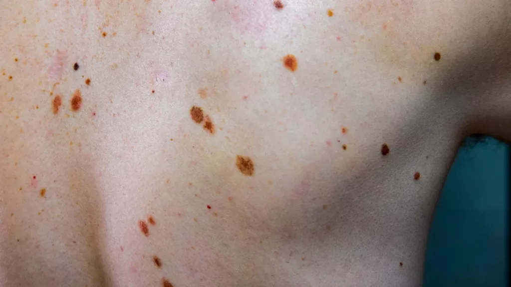 mole-body1