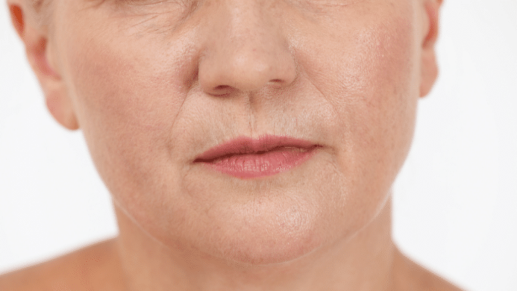 smokers-lines-how-to-get-rid-of-upper-lip-lines-wrinkles-1200x676