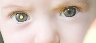 eye-5