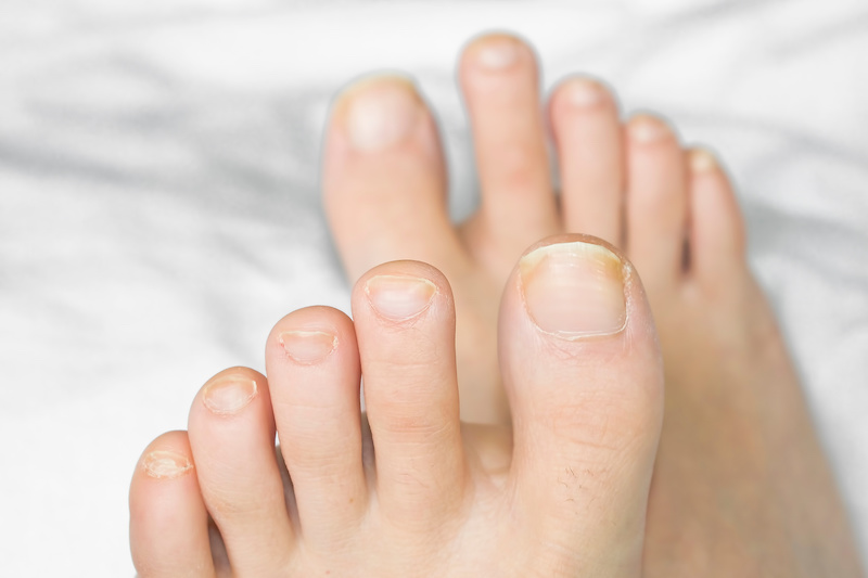 toenails-on-a-womans-feet