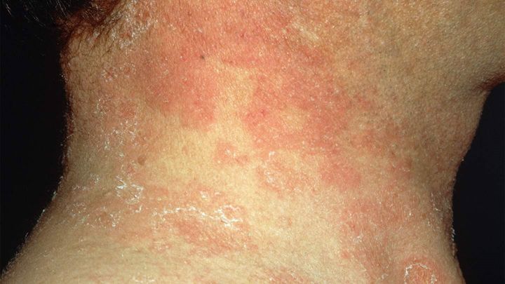 whats-wrong-with-your-skin-04-rm-1440x810